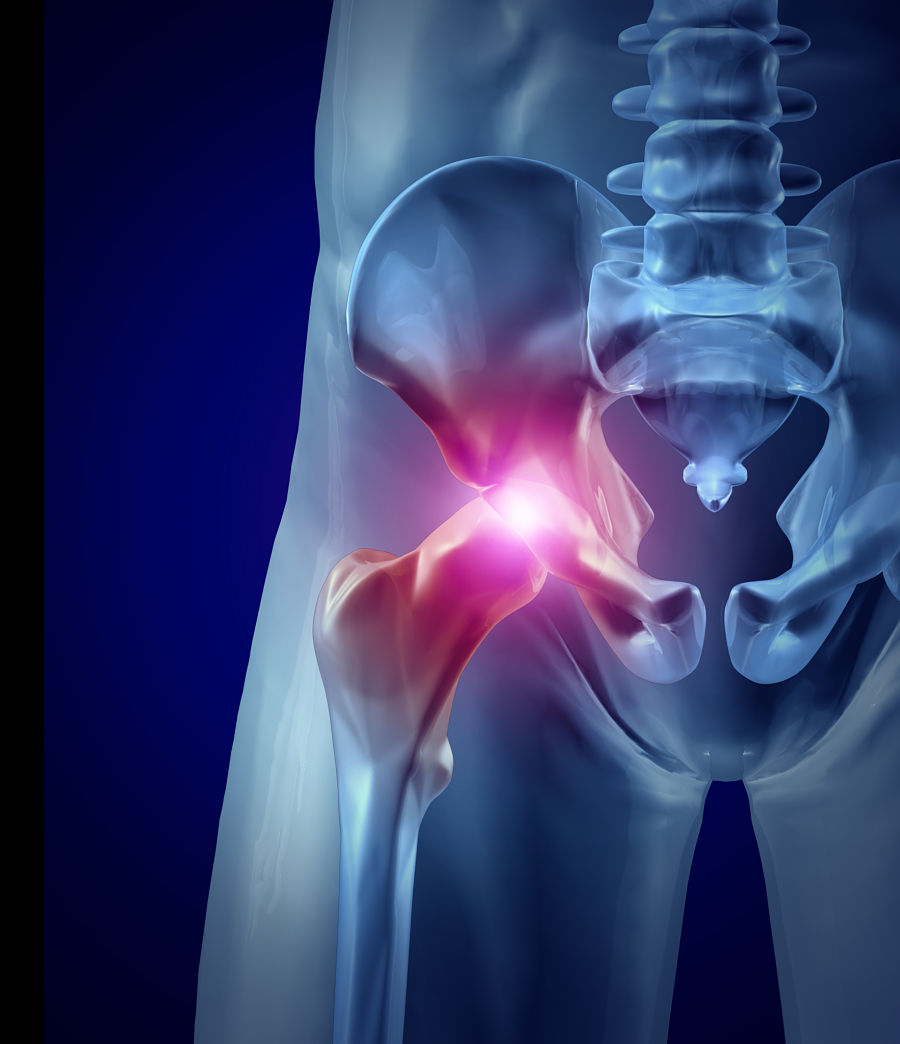 Hip injury attorneys